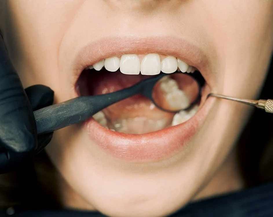 A dentist uses a mirror to examine the back of a patient's mouth.