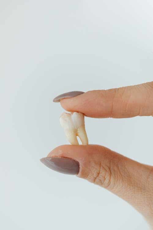 A dentist holds an extracted molar.